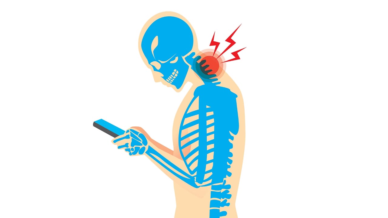 Text Neck Syndrome by Dr. Ajay Kothari
